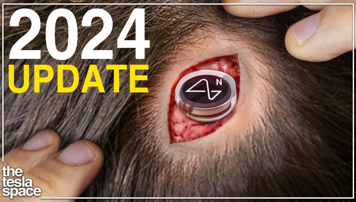 The 2024 Neuralink Update Is Here….12-26-2023