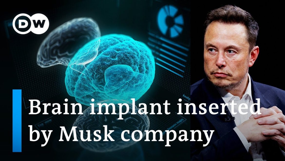 Elon Musk’s start-up Neuralink implants first chip in human brain | DW News….01-30-2024
