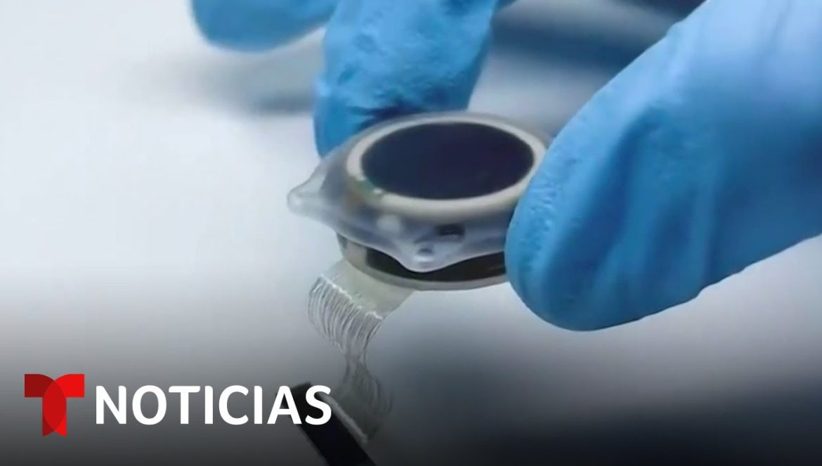 Reacciones tras anuncio de la implantación de un curioso chip en el cerebro | 01-31-2024