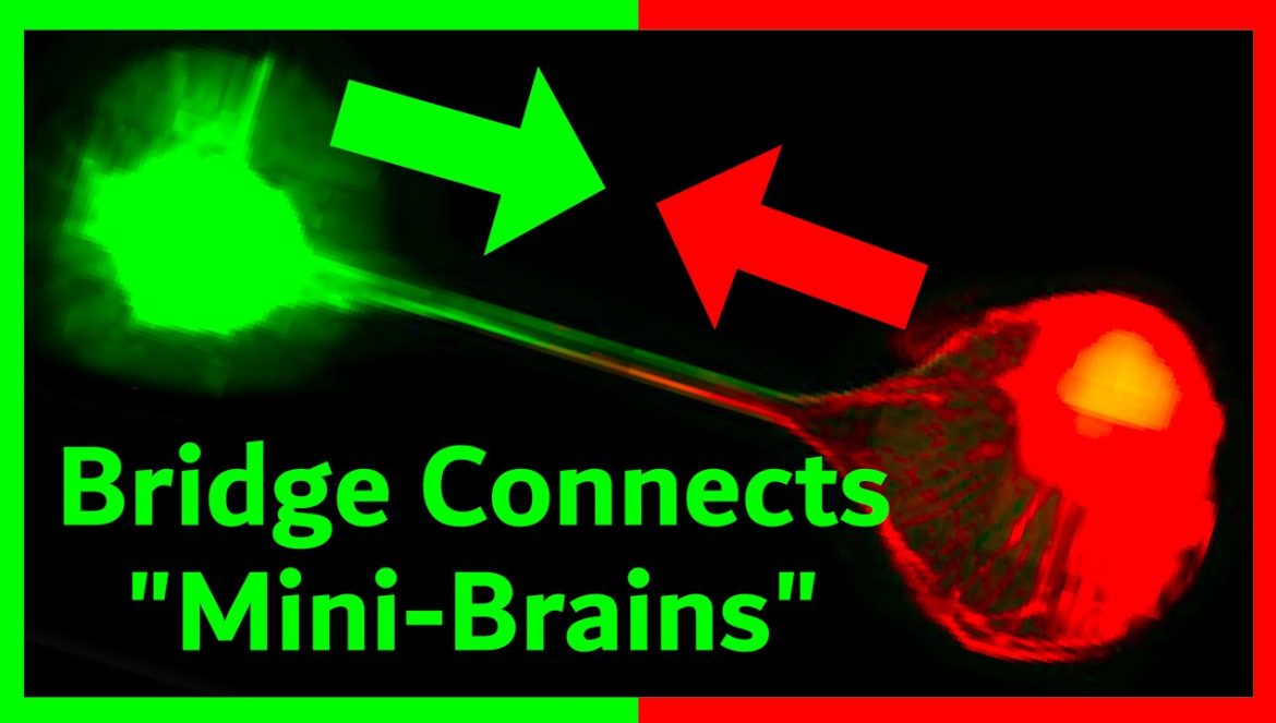 Brain Organoids Communicate: A Step Toward “Organoid Intelligence”