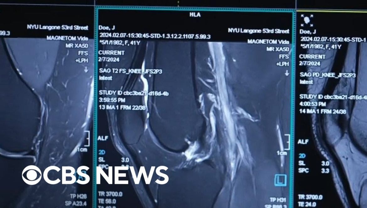 Breakthrough MRI technology uses AI for faster scans….04-26-2024