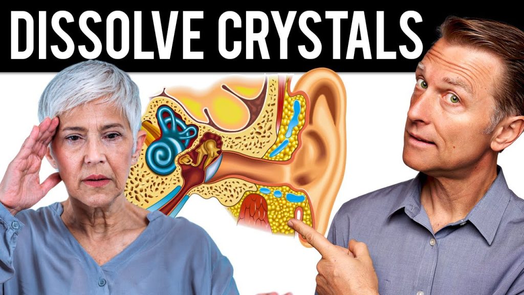 How to Dissolve Crystals in the Inner Ear and Get Rid of Vertigo….05-05-2024