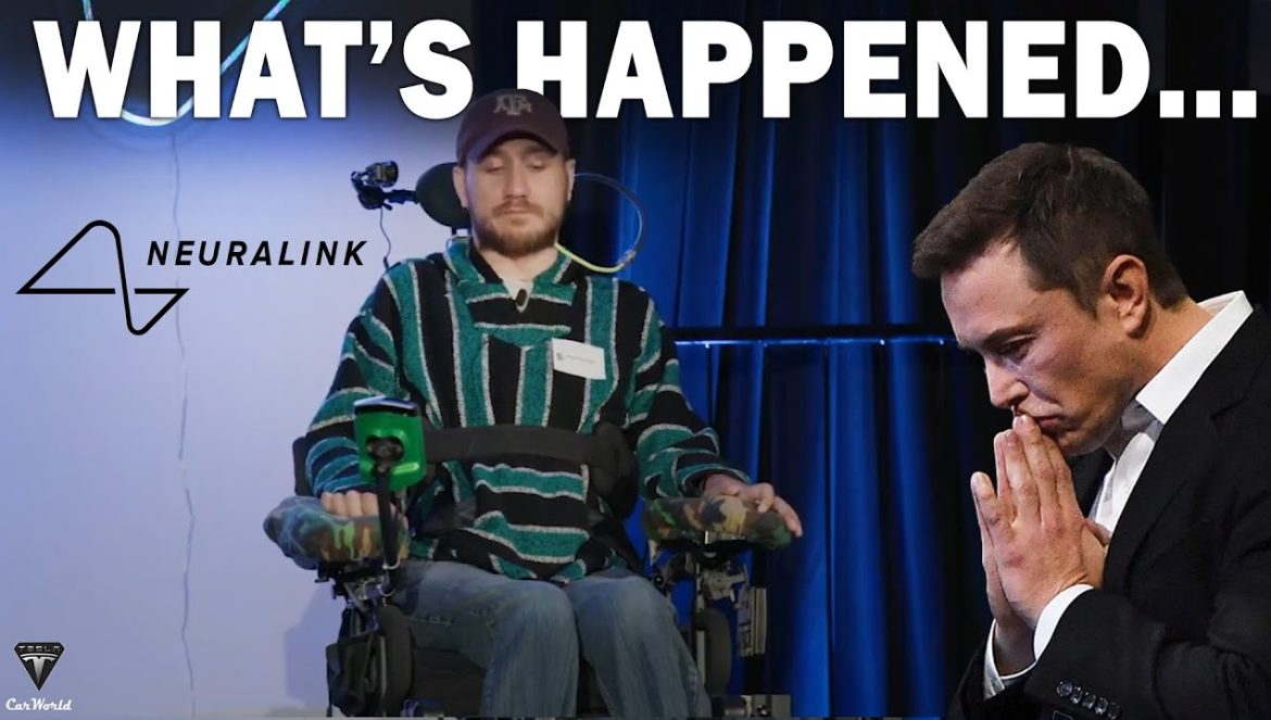 Something BIG Happened with Neuralink Problem First Patient! N1 Chip Shock Entire Industry….05-13-2024