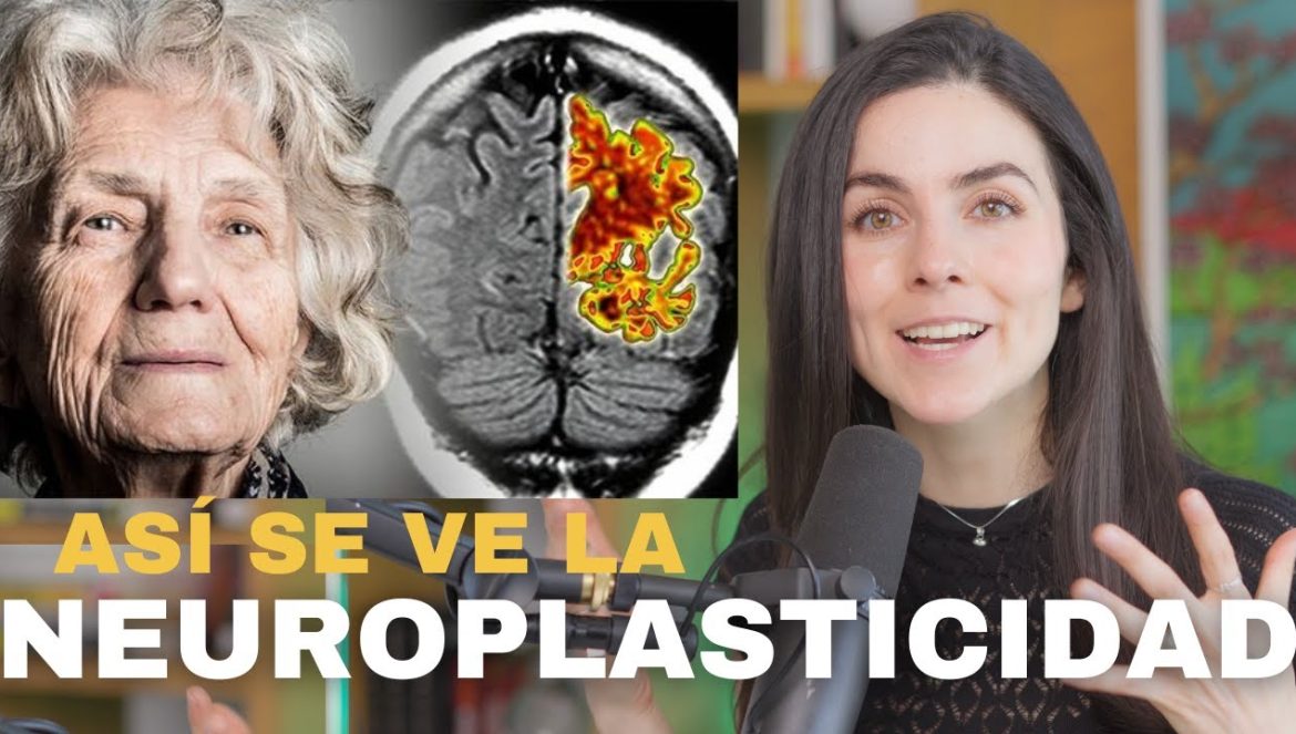 Tu cerebro está envejeciendo. Esto es lo que puedes hacer….07-19-2024