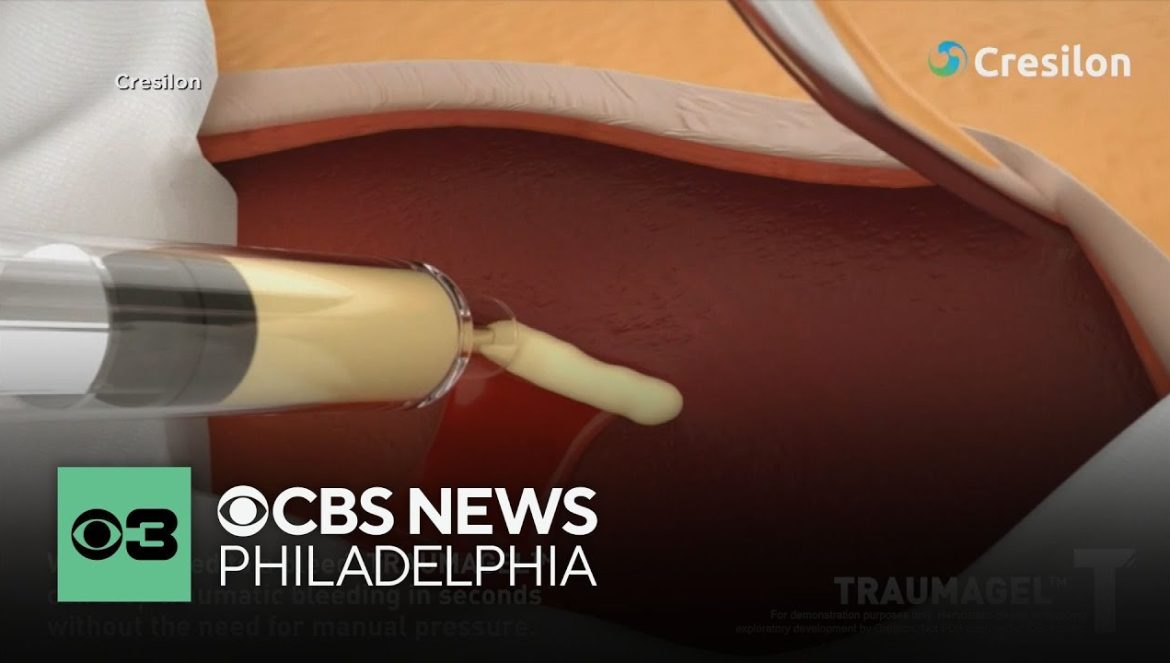 FDA clears new way to stop severe bleeding in seconds….08-19-2024