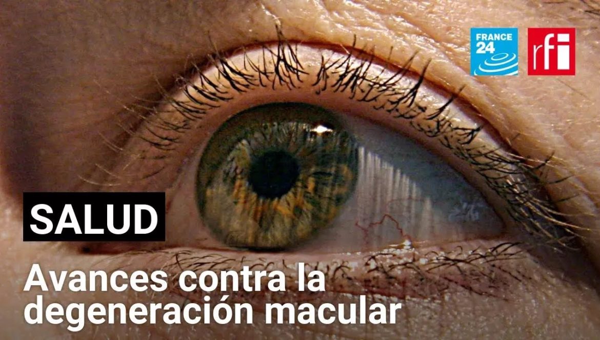 Un laboratorio francés desarrolla un prometedor implante de retina….02-28-2025