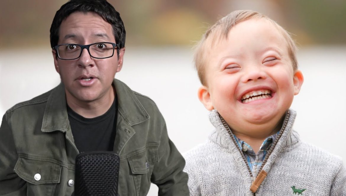 ¡Gran Avance Para el Tratamiento del Síndrome de Down!….03-04-2025