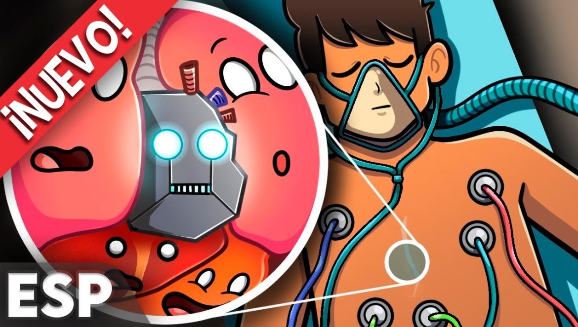 ¿Qué Pasa si Tienes un TRASPLANTE de Corazón?….05-04-2025